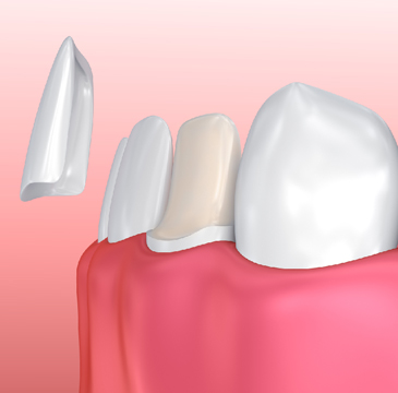 Treatment - Denchicdentalspa